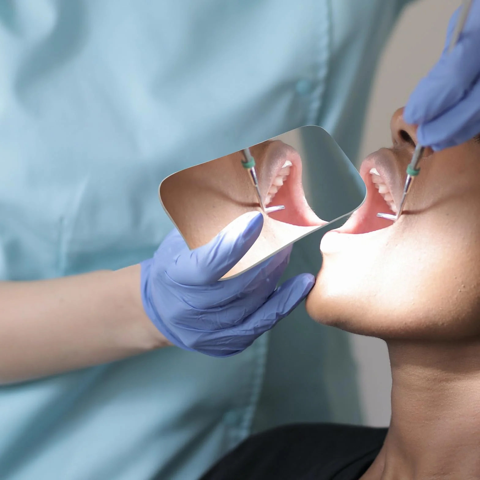 FOMIYES 2 Uds Espejos de Fotografía Dental Reflectores Oclusales Doble Espejo Intraoral