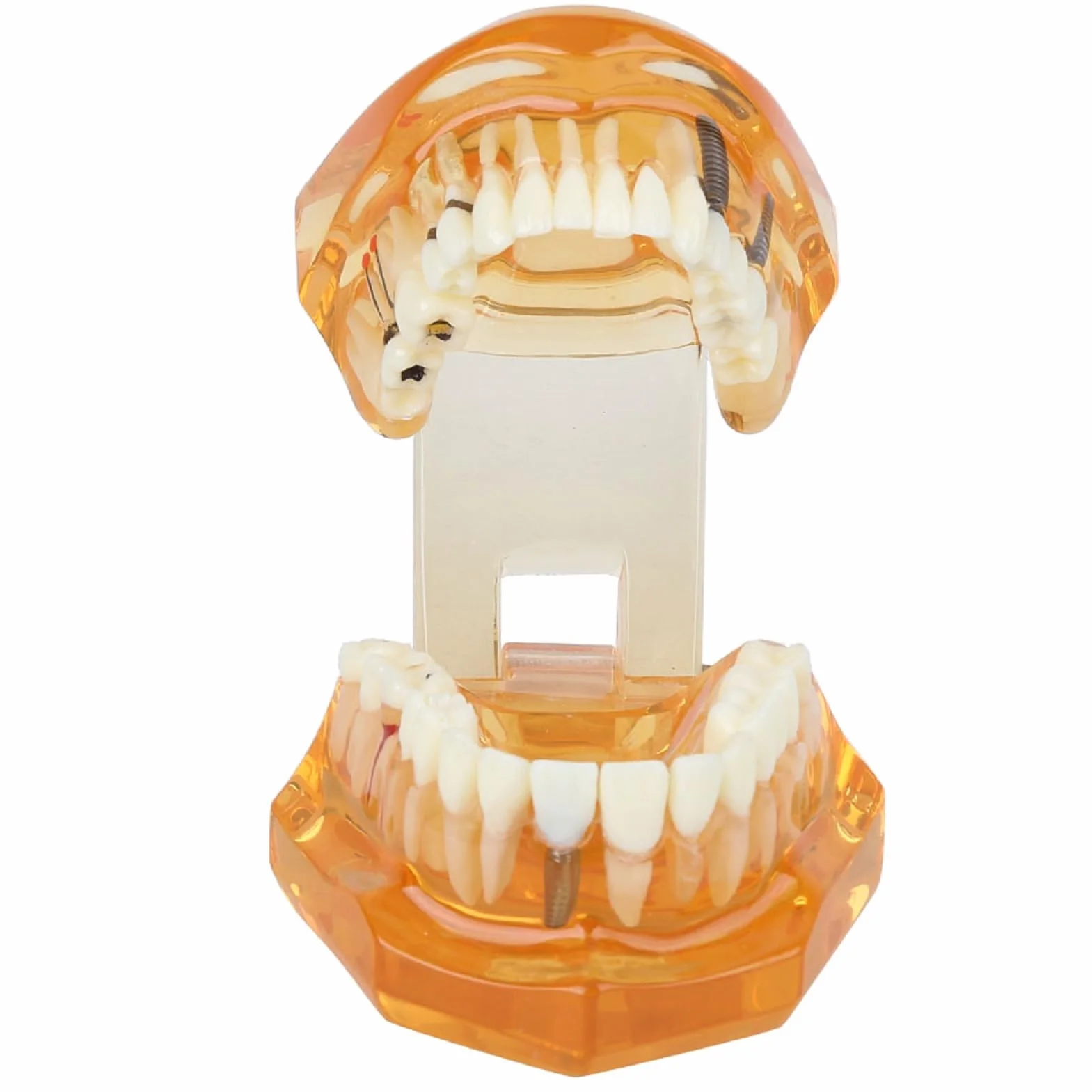 Modelo de Estudio de Dientes Dentales Extraíbles para Enseñanza Demostración Sobredentadura Maxilar Clínica Laboratorio Dentista