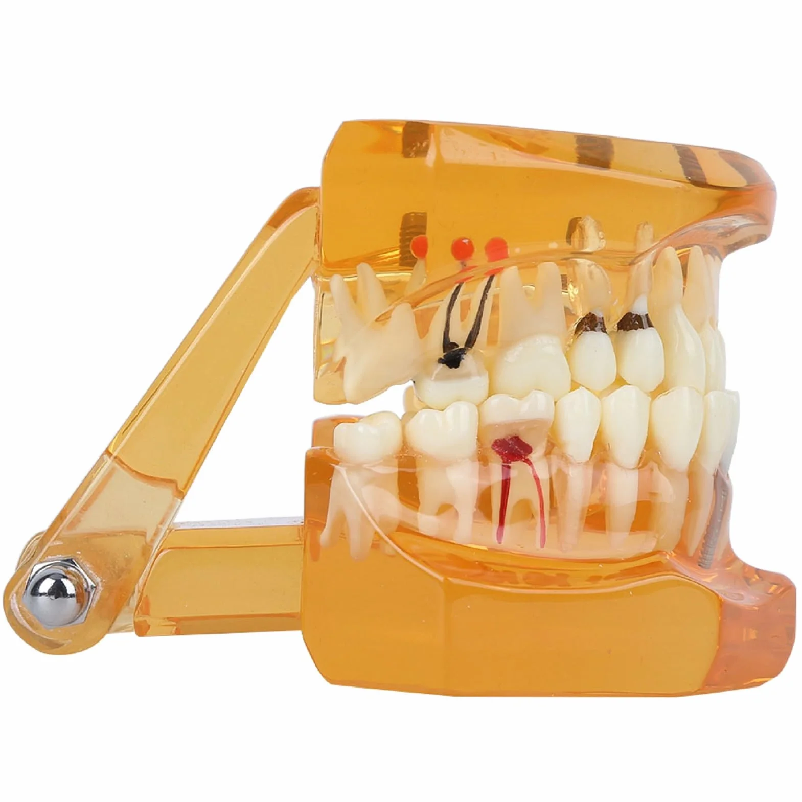 Modelo de Estudio de Dientes Dentales Extraíbles para Enseñanza Demostración Sobredentadura Maxilar Clínica Laboratorio Dentista