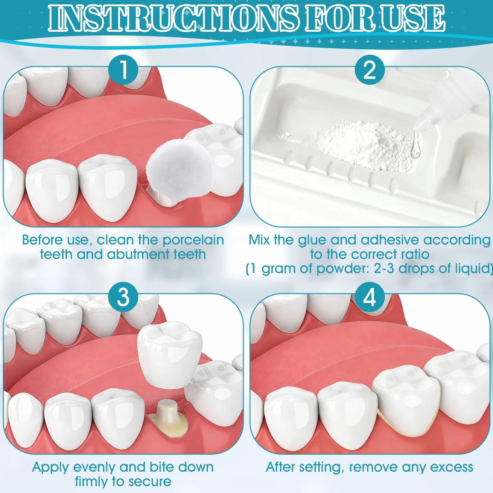 Cemento Dental para Corona y Puente Composite
