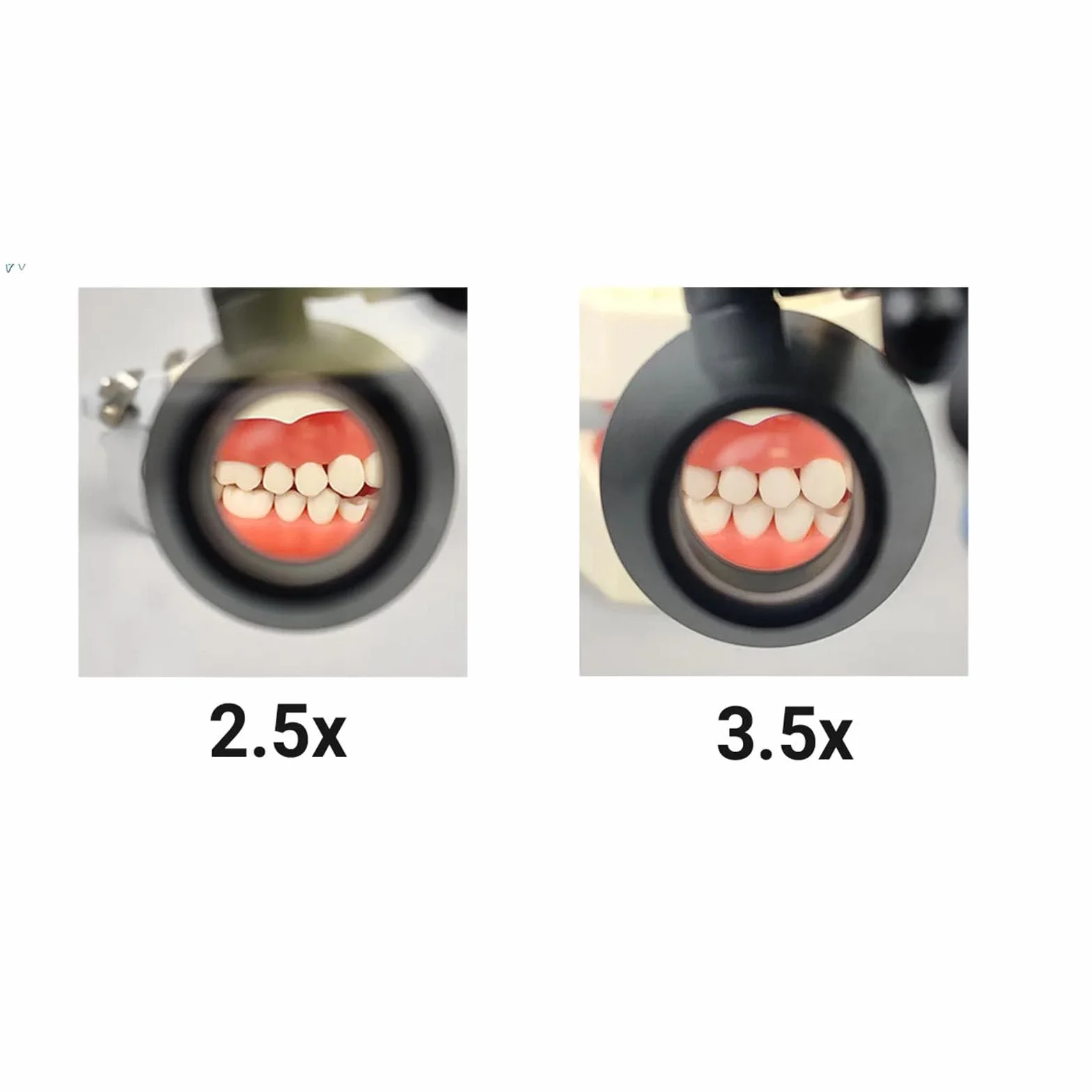 Lupas dentales quirúrgicas 3,5X binocular para laboratorio odontología
