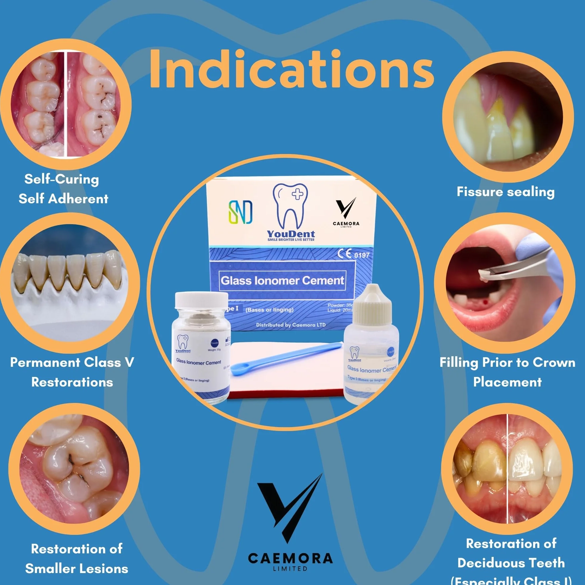 Caemora Kit de reparación dental Cemento dental de ionómero de vidrio Relleno permanente