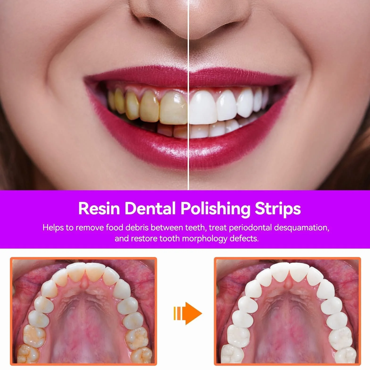 Tiras Dentales Pulidoras Doble Cara 50um Papel De Lija Dental Herramienta De Cuidado Oral