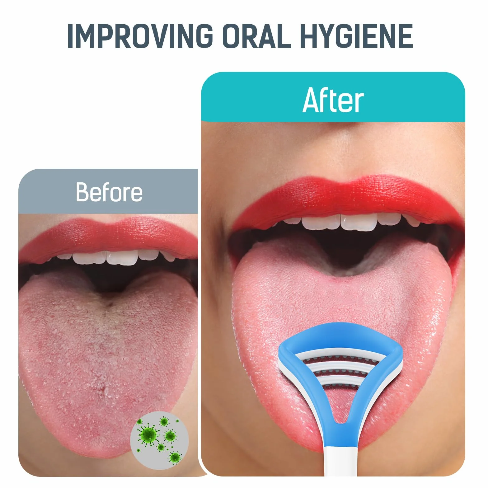 Morpilot Irrigador Bucal Dental Inalámbrico 3 Modos 5 Boquillas IPX7 300ML