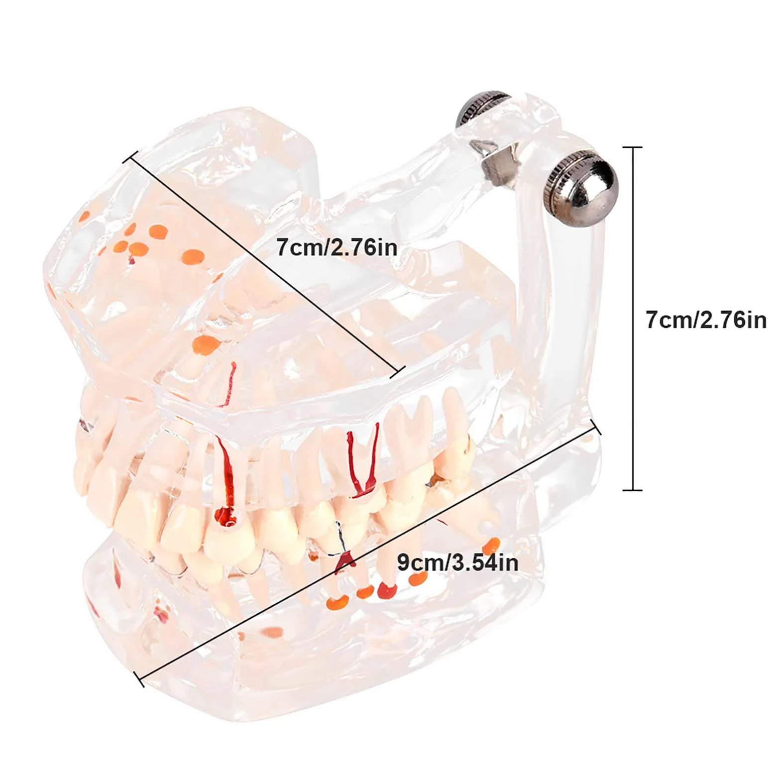 Modelo de Dientes Estándar para Estudiantes de Odontología, Herramienta Educativa Transparente