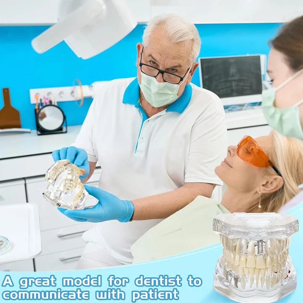 Typodonts Dental Modelo de Dientes para Implantes con Dientes Desmontables