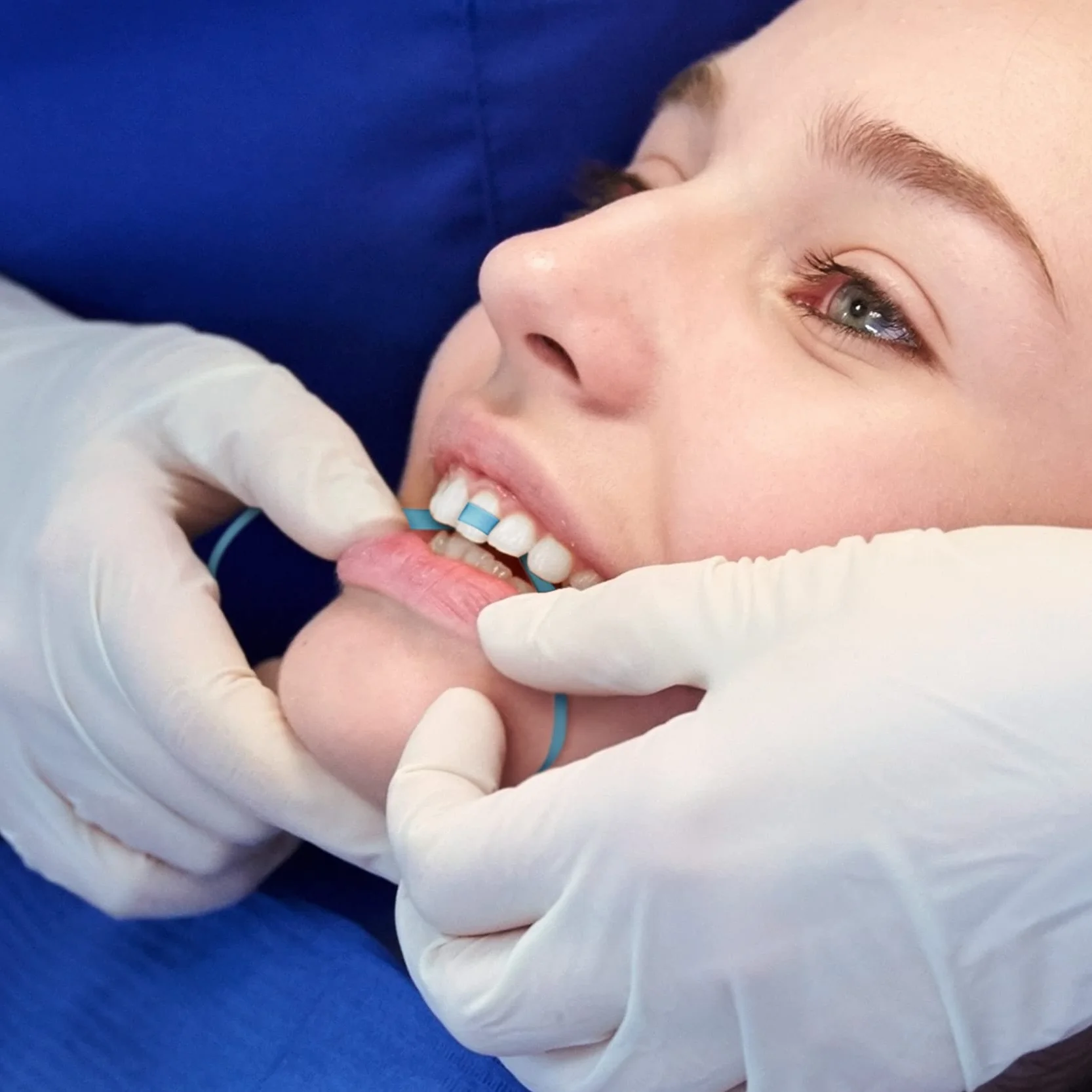 Annhua Tiras de Pulido Dental Abrasivo y Acabado 4mm x 6M Fine Azul