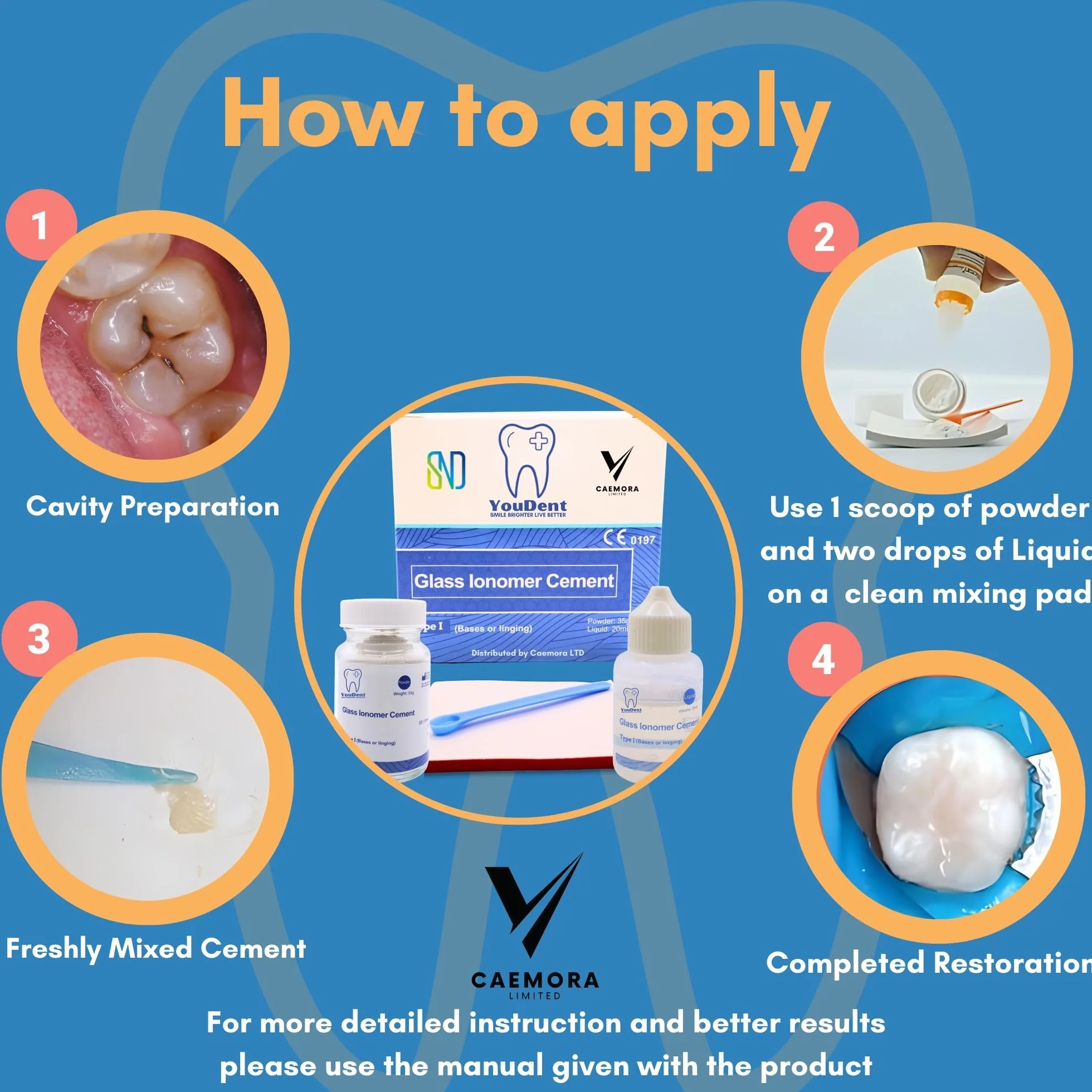 Caemora Kit de reparación dental Cemento dental de ionómero de vidrio Relleno permanente