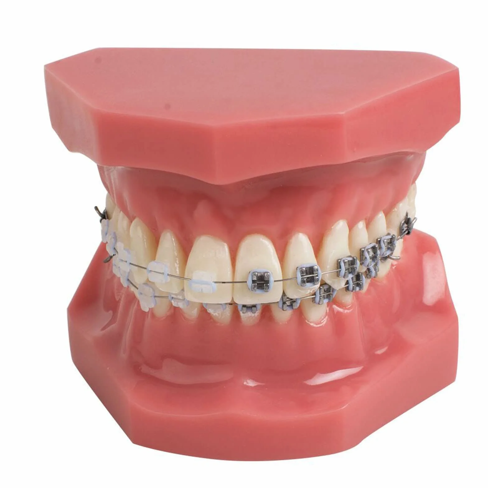 Modelo de Dientes Dentales de Ortodoncia con Brackets Cerámicos y Metálicos para Enseñanza Odontológica
