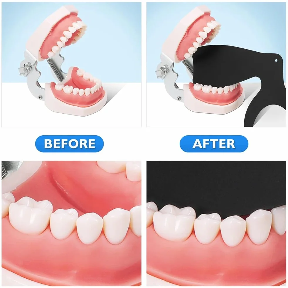 Kit de fotografía intraoral de contrastes dentales 6 piezas
