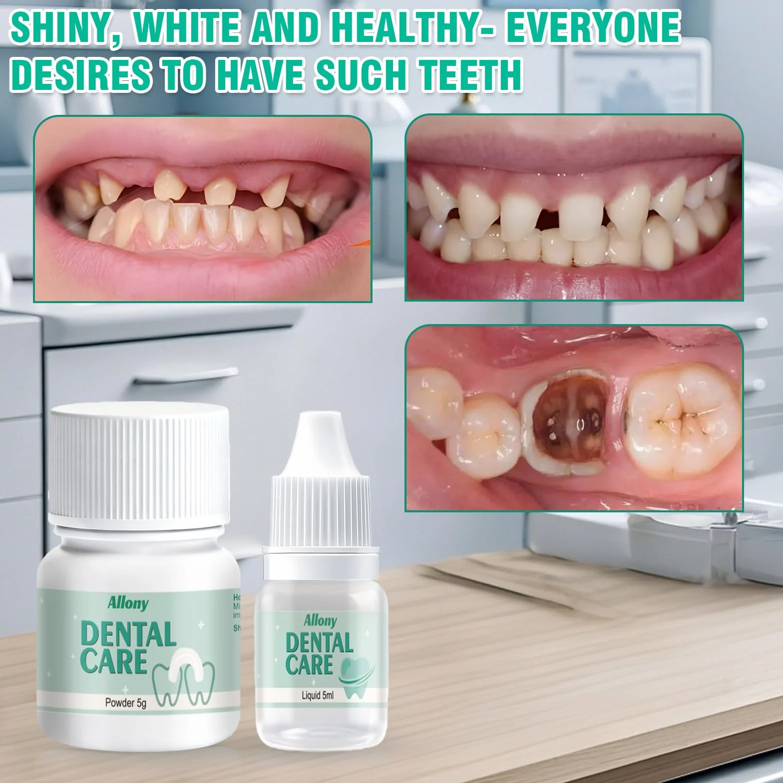 Cemento Dental Composite Kit de Fijación para Corona y Puente