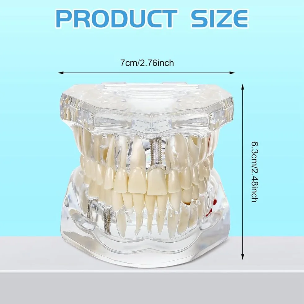 Typodonts Dental Modelo de Dientes para Implantes con Dientes Desmontables