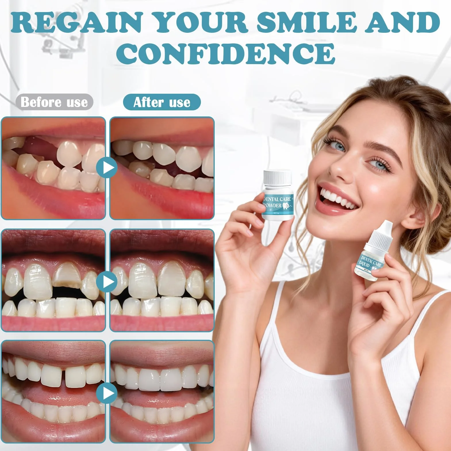 Pegamento Dental Cemento Kit de Fijación para Corona Puente Rellenar Caries