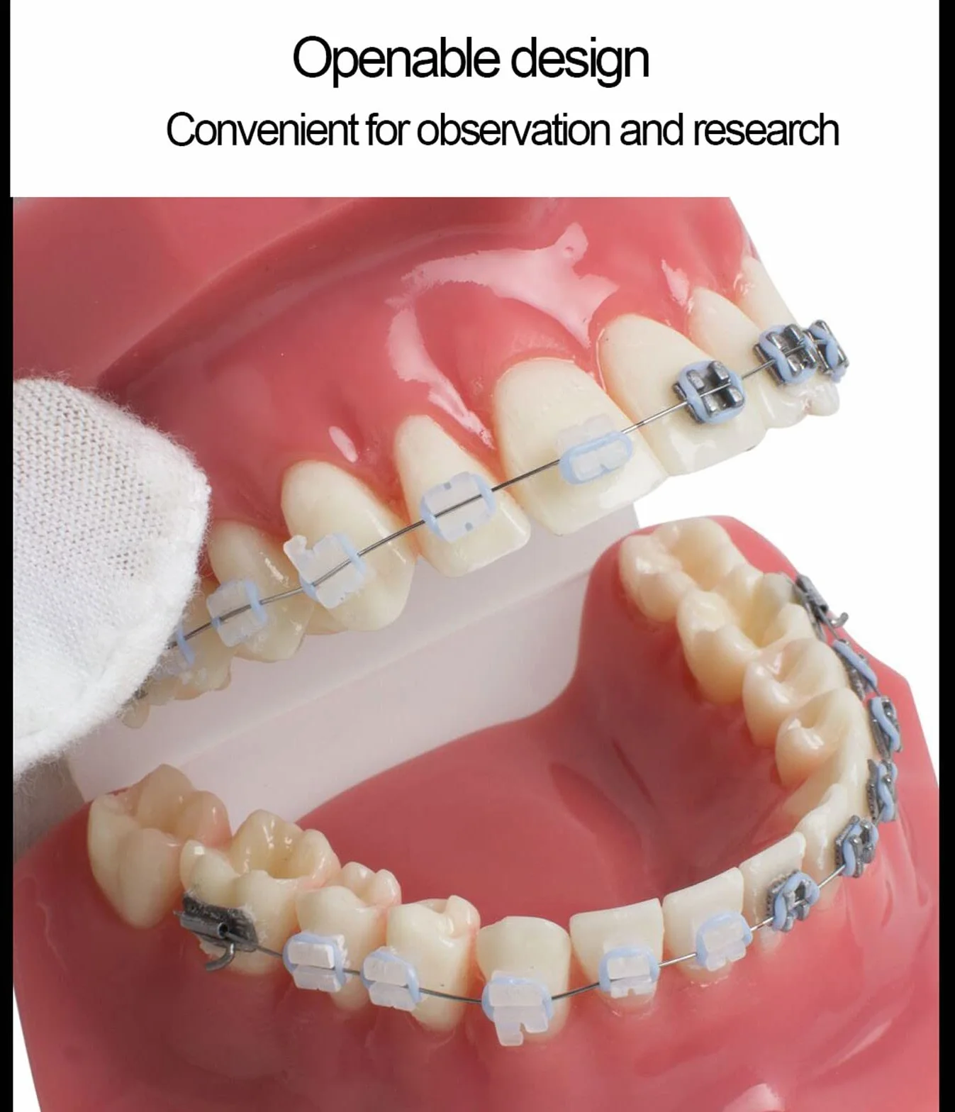 Modelo de Dientes Dentales de Ortodoncia con Brackets Cerámicos y Metálicos para Enseñanza Odontológica
