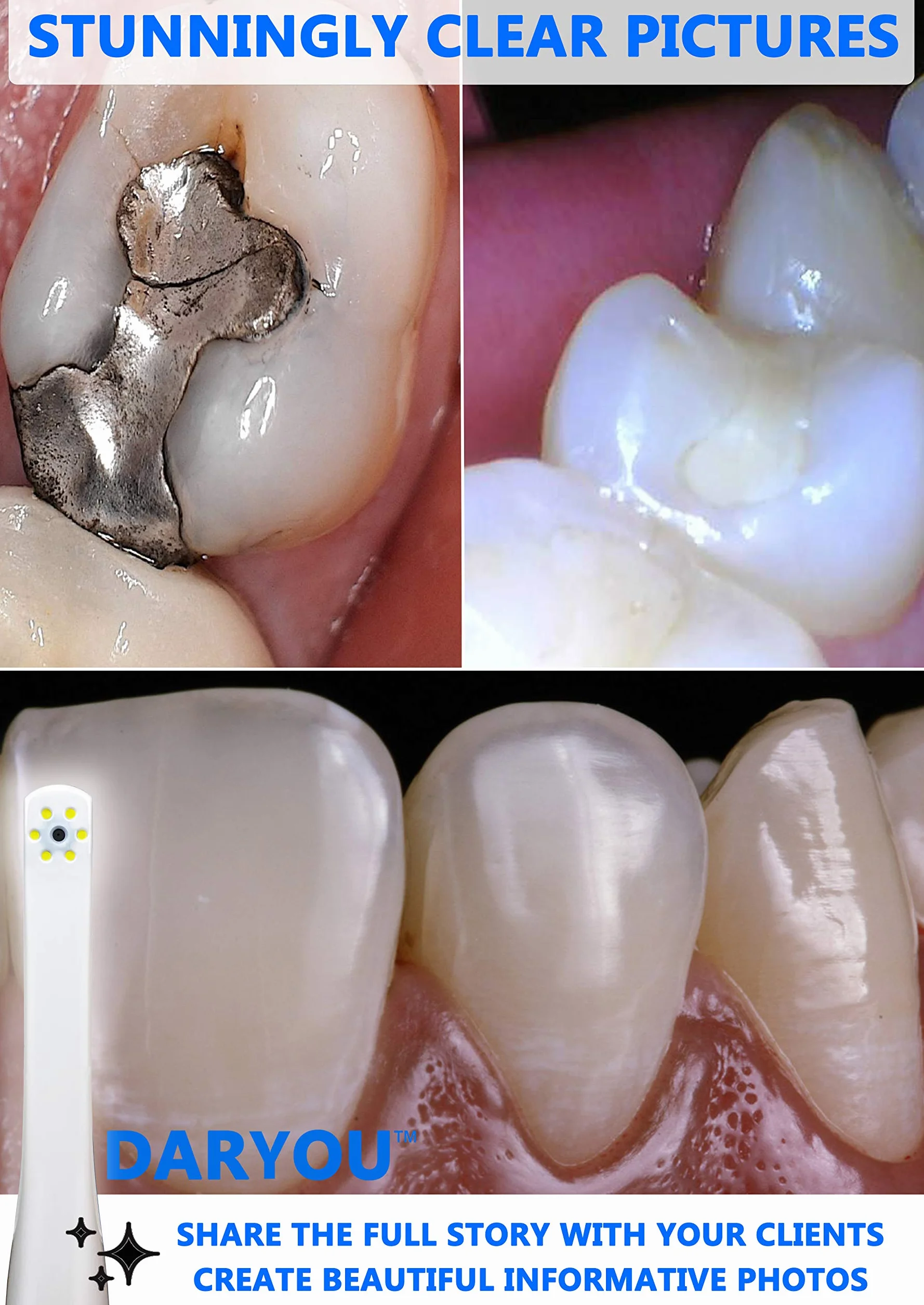Cámara dental intraoral DY-50 compatible con Examine Pro Logosu DBSwin Vixwin Eaglesoft Dexis