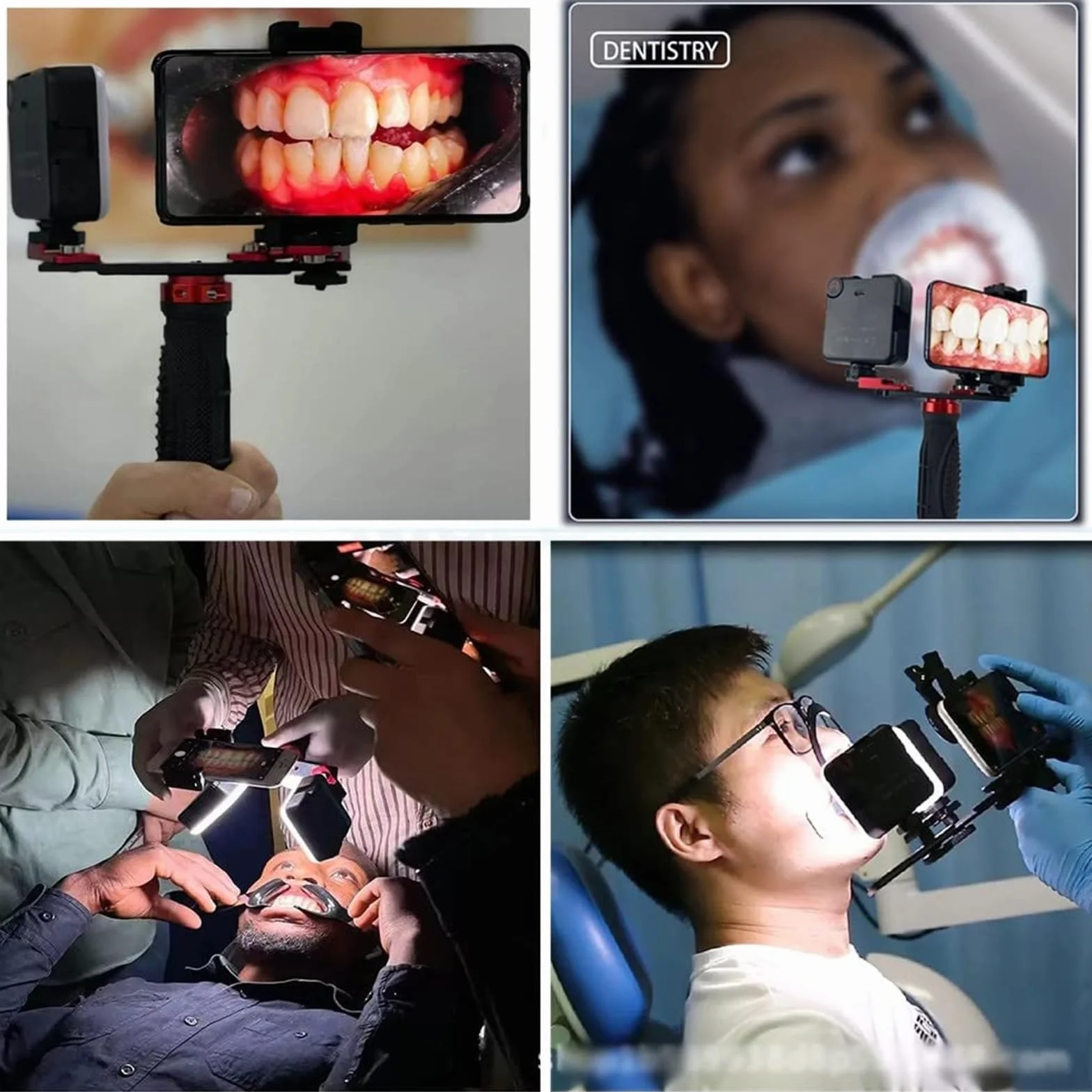 Kit de Iluminación Dental LED 360° Ajustable para Fotografía con Cámara de Teléfono Móvil