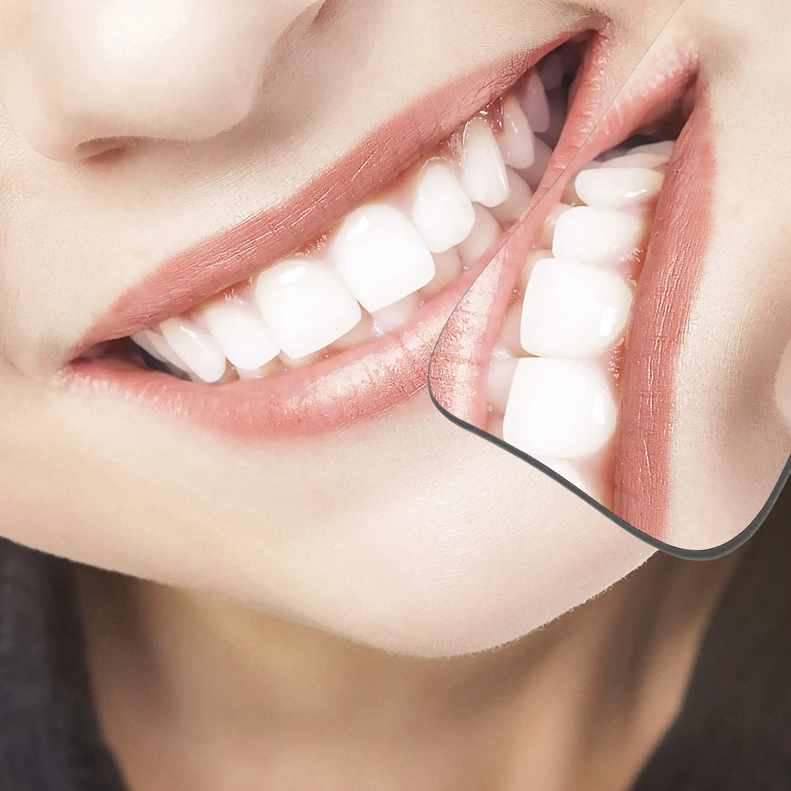 Healifty Reflector Dental De Doble Cara Para Fotografía Intraoral 4.64x2.55x0.19in