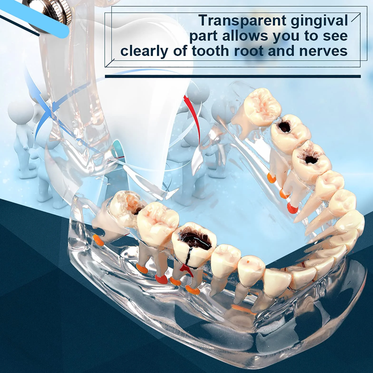 Modelo de Dientes Estándar para Estudiantes de Odontología, Herramienta Educativa Transparente