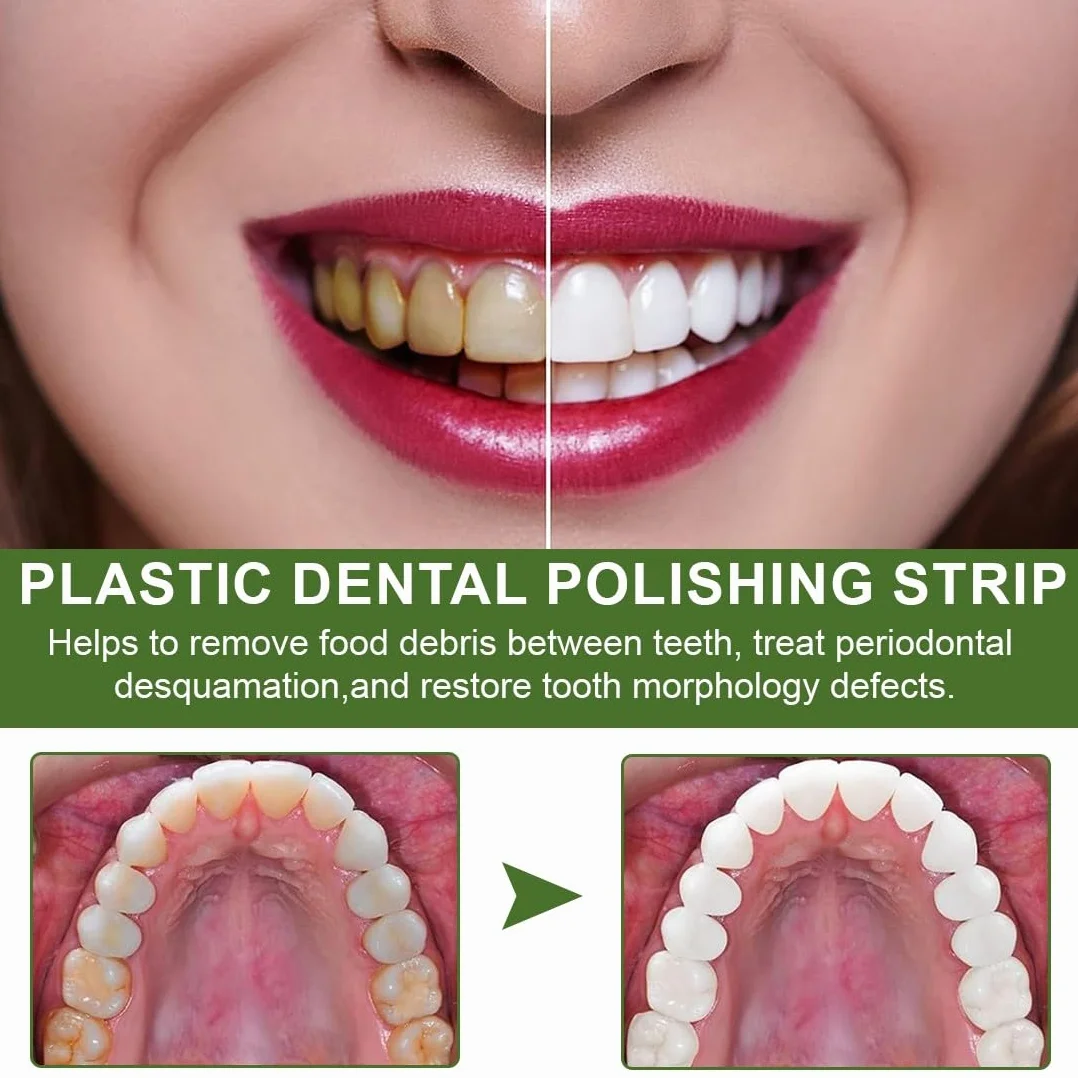 Caja De Tiras De Pulido Dental 6 Metros Pulidor De Dientes De Doble Cara Papel De Lija Dental 30μ