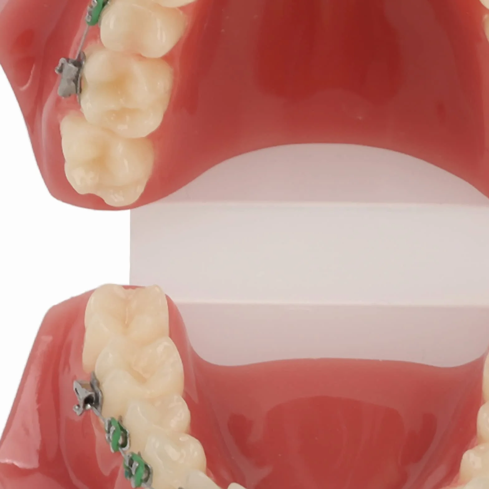 Modelo de Ortodoncia Profesional con Brackets Cerámicos y Metálicos para Enseñanza Odontológica