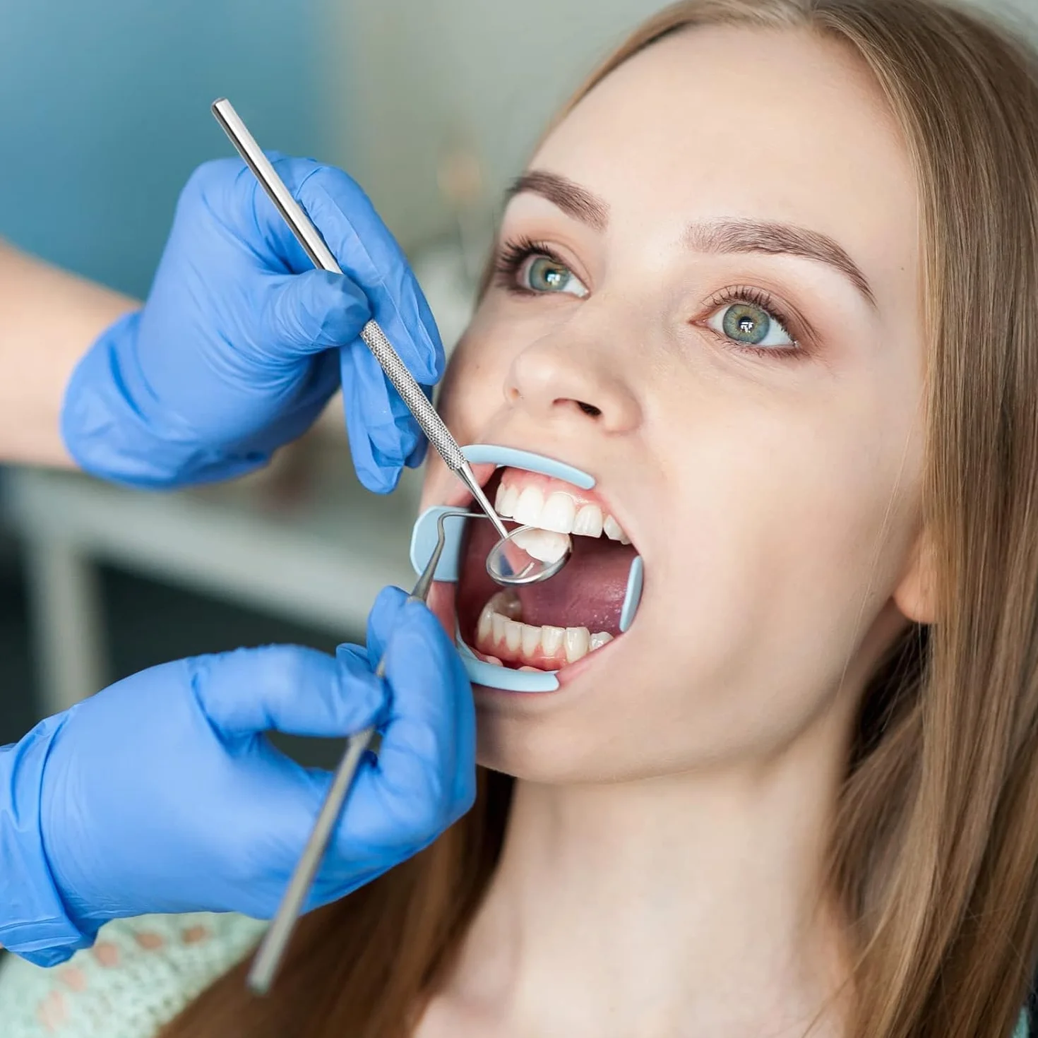 YSCARE Espejo de boca dental para dentista higiene oral herramienta de extensión de boca y pestañas