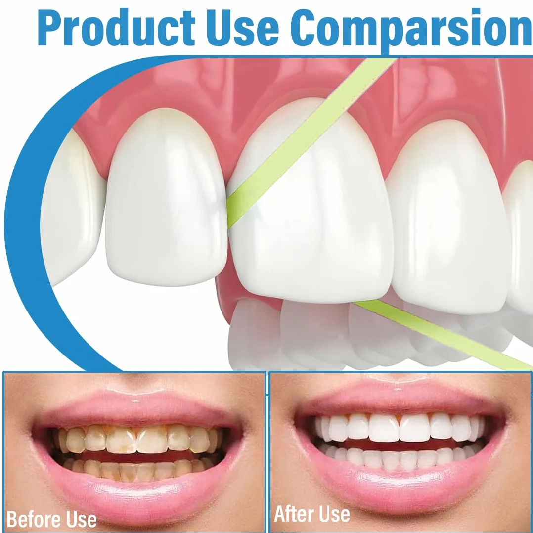 Papel De Lija Dental 3 Volúmenes, Tiras De Pulido Intersticial, Para Blanqueamiento Dental