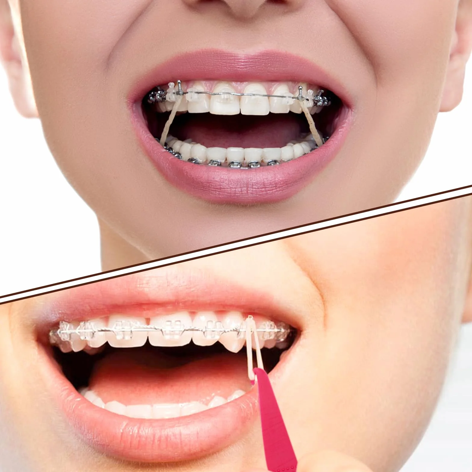 VEGCOO 600 Piezas Goma Elástica Ortodoncia, Multiusos Elásticos Dientes con 6 Colocadores Plástico (1/8, 3.5 oz)