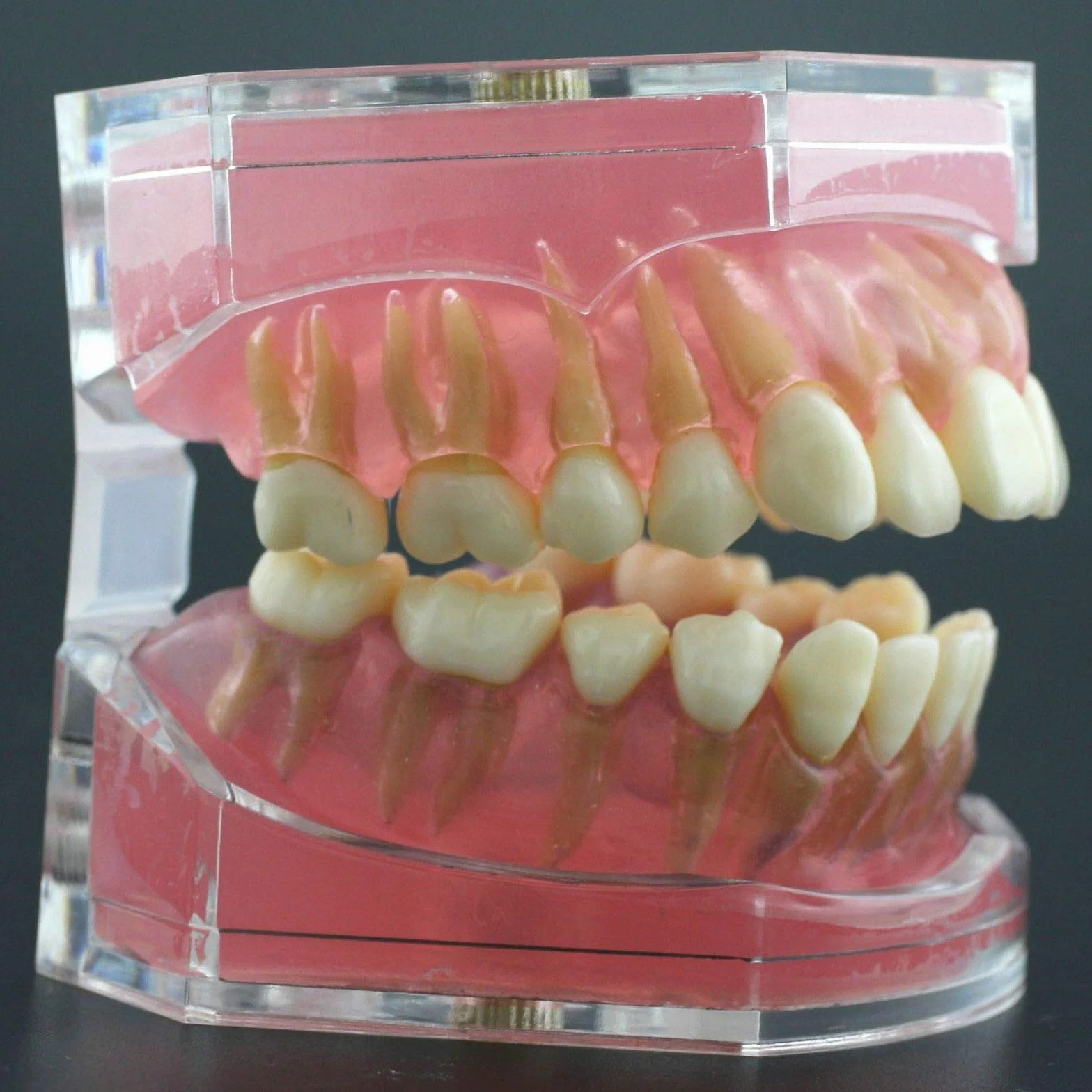 Modelo de Dientes Encías Blandas Desmontable para Enseñanza Dental Ejercicios de Extracción