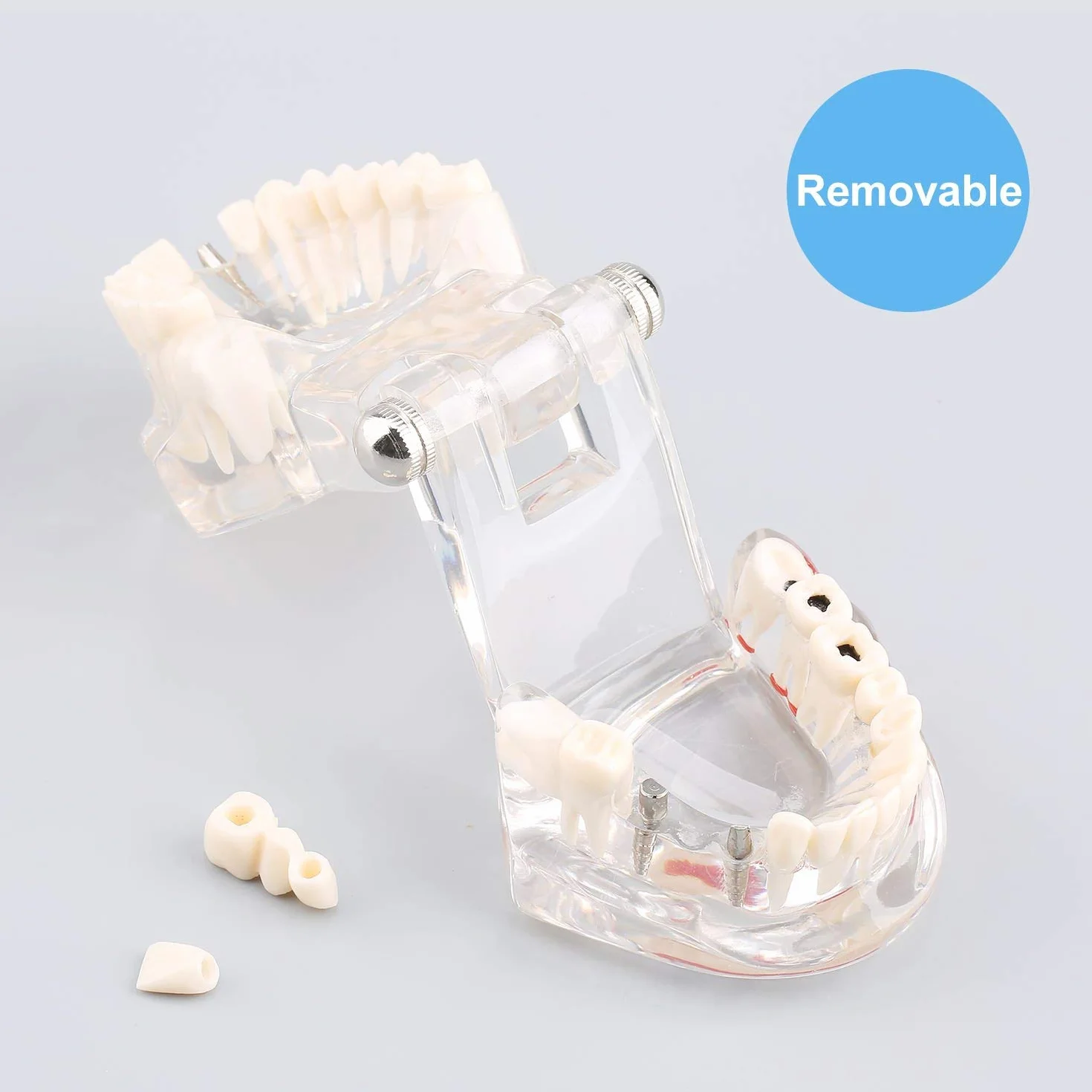 Modelo de Dientes Desmontable Adultos, Implantes Dentales, Enfermedad Transparente, Patología de Enseñanza