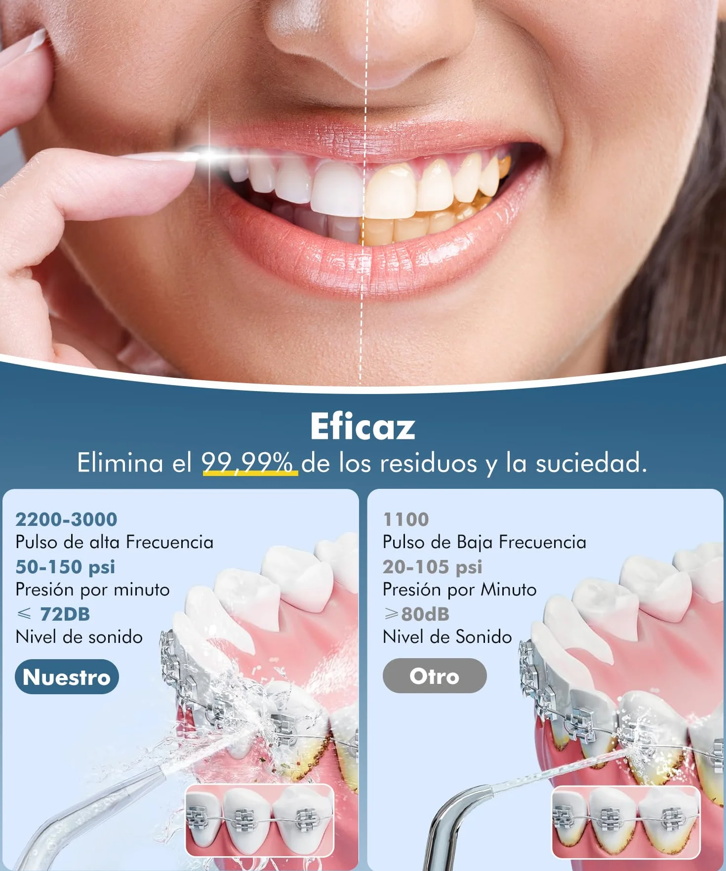 Irrigador Dental Portatil Profesional Inalámbrico 5 Boquillas 4 Modos IPX7 USB-C Recargable