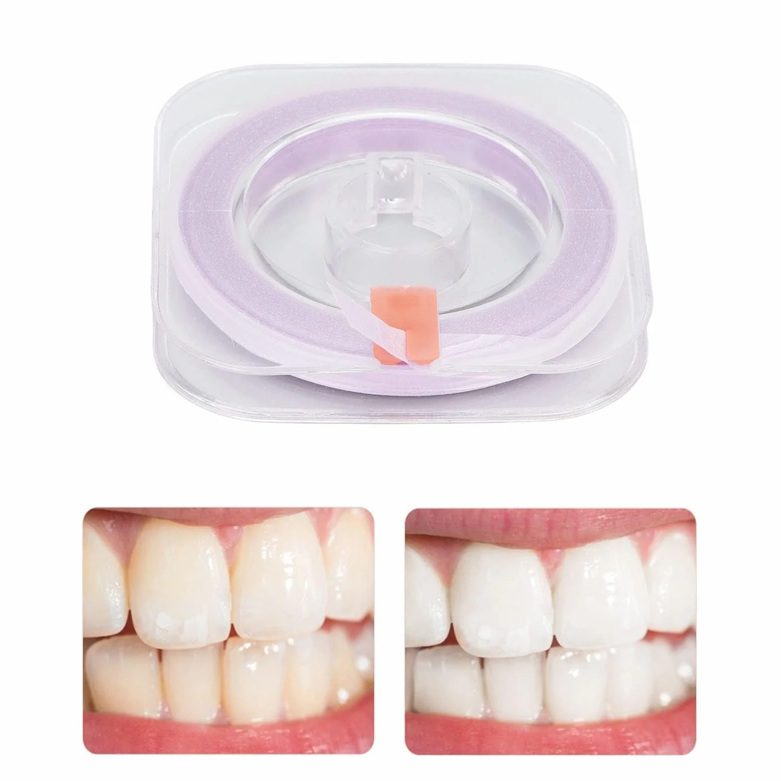 Tiras Dentales Pulidoras Doble Cara 50um Papel De Lija Dental Herramienta De Cuidado Oral