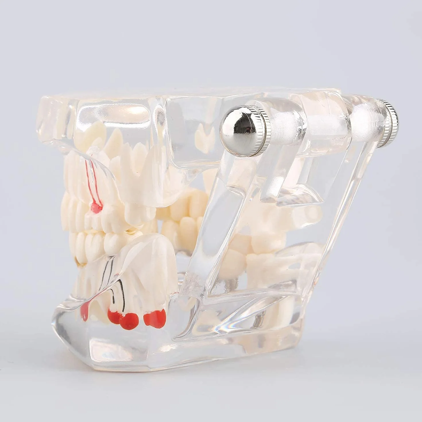 Modelo de Dientes Desmontable Adultos, Implantes Dentales, Enfermedad Transparente, Patología de Enseñanza