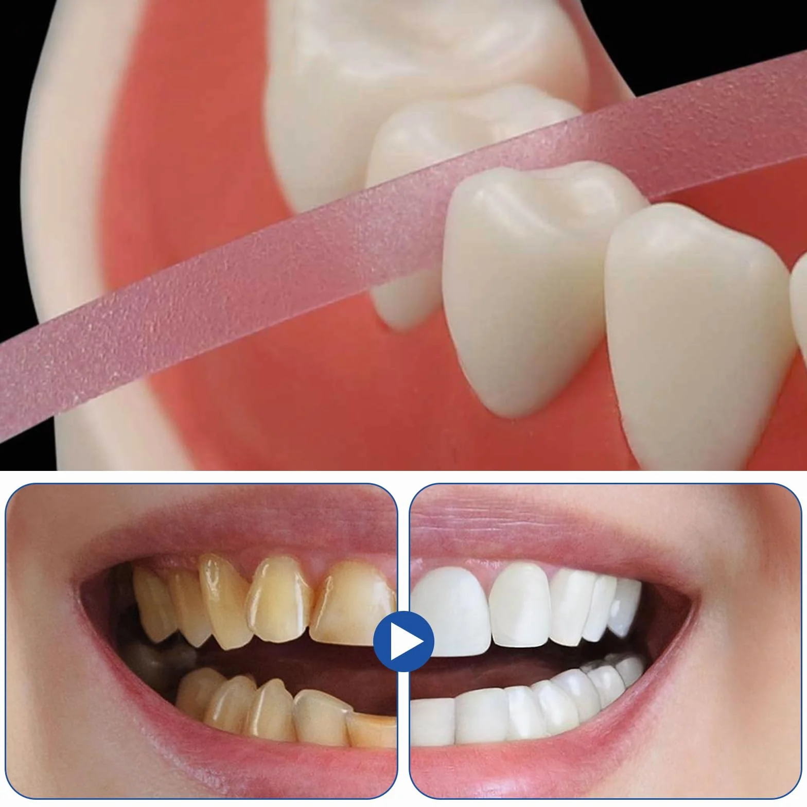 Papel de Lija Interdental Tiras de Lijado Dental 3 Volúmenes para Limpieza Bucal