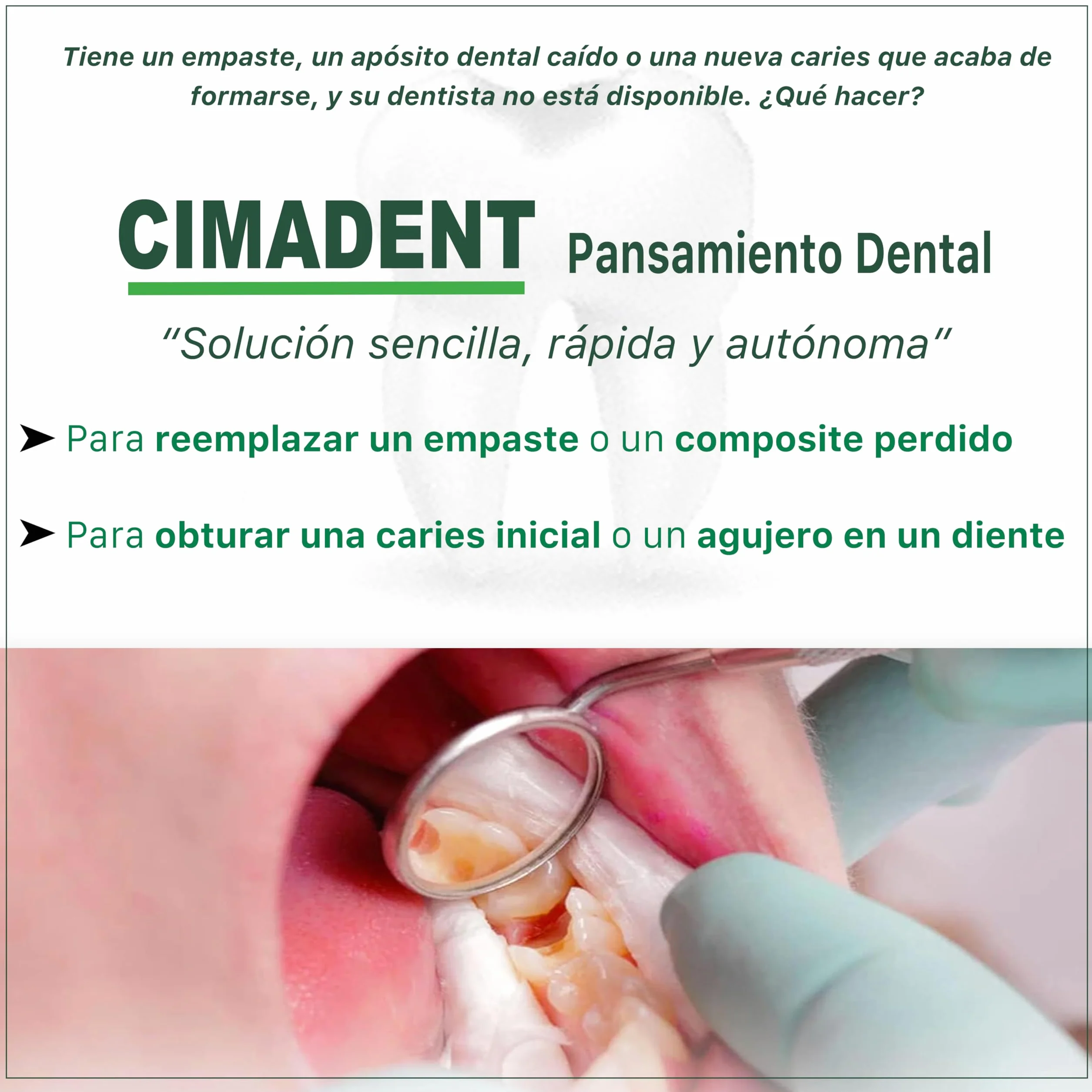 EMPASTE DENTAL CIMADENT 30 aplicaciones para empaste dental en casa