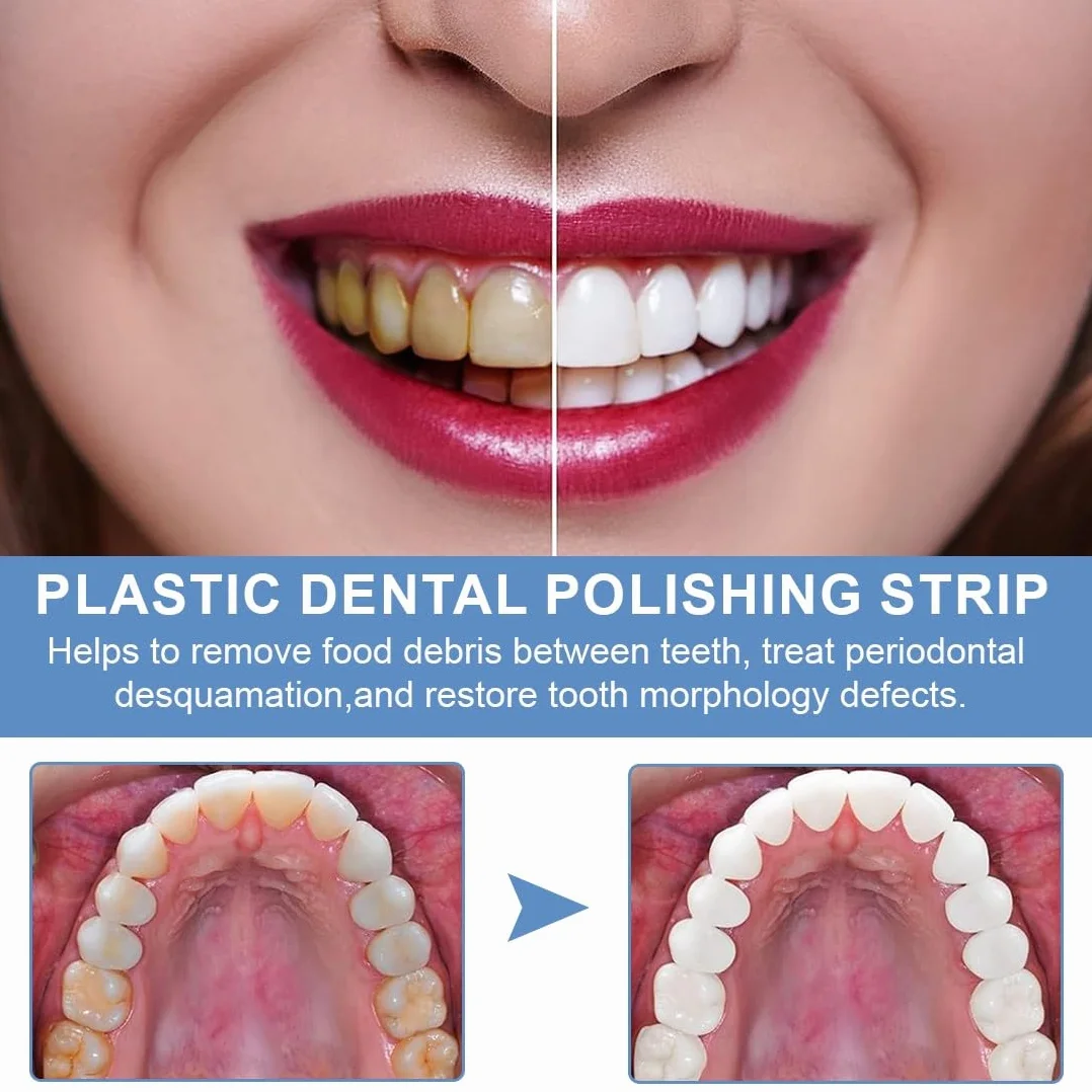 Papel De Lija Dental 6 Metros Doble Cara, Lima Dental Para Dientes, Herramienta Cuidado Bucal Limpieza Profunda 30μ