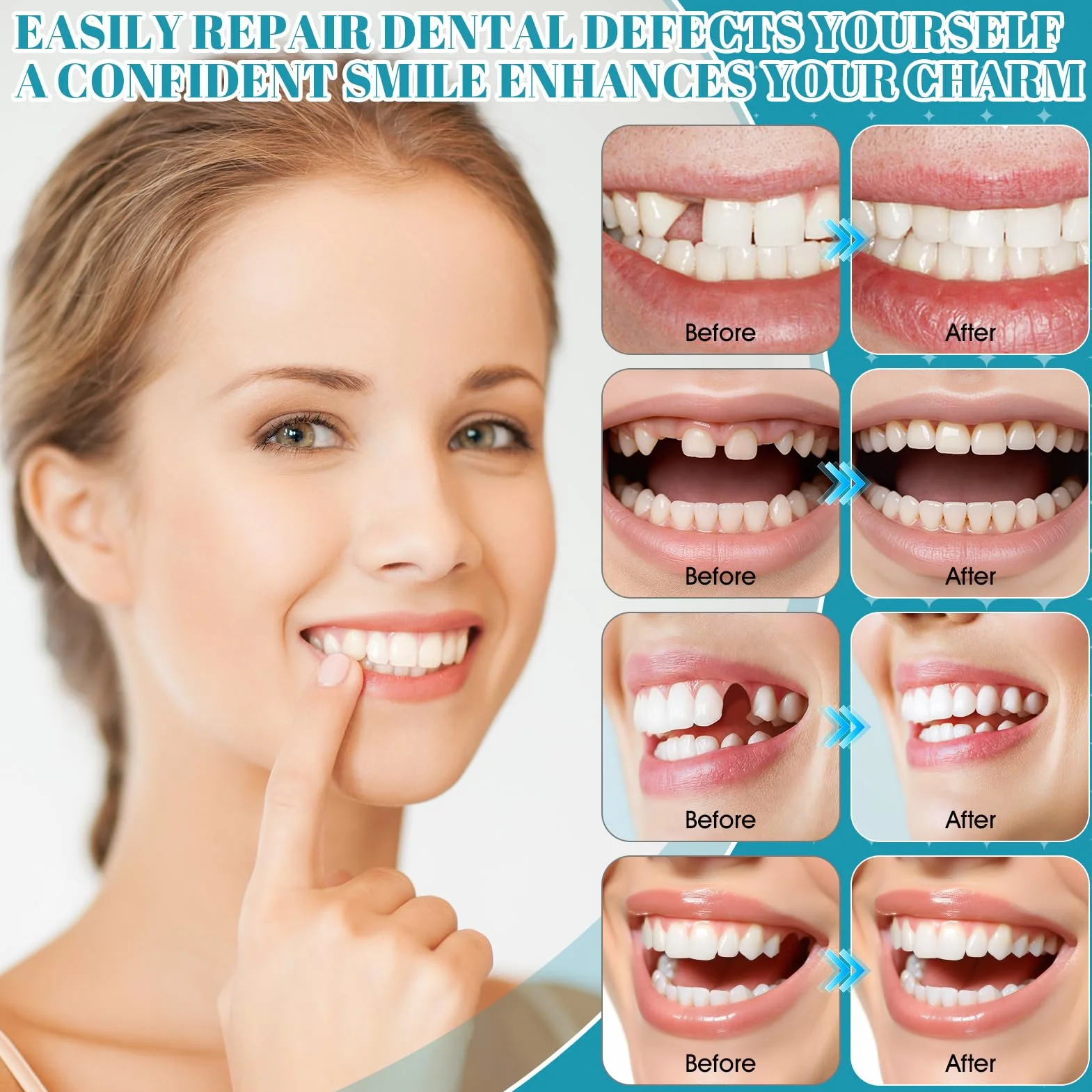 Cemento Dental para Corona y Puente Composite