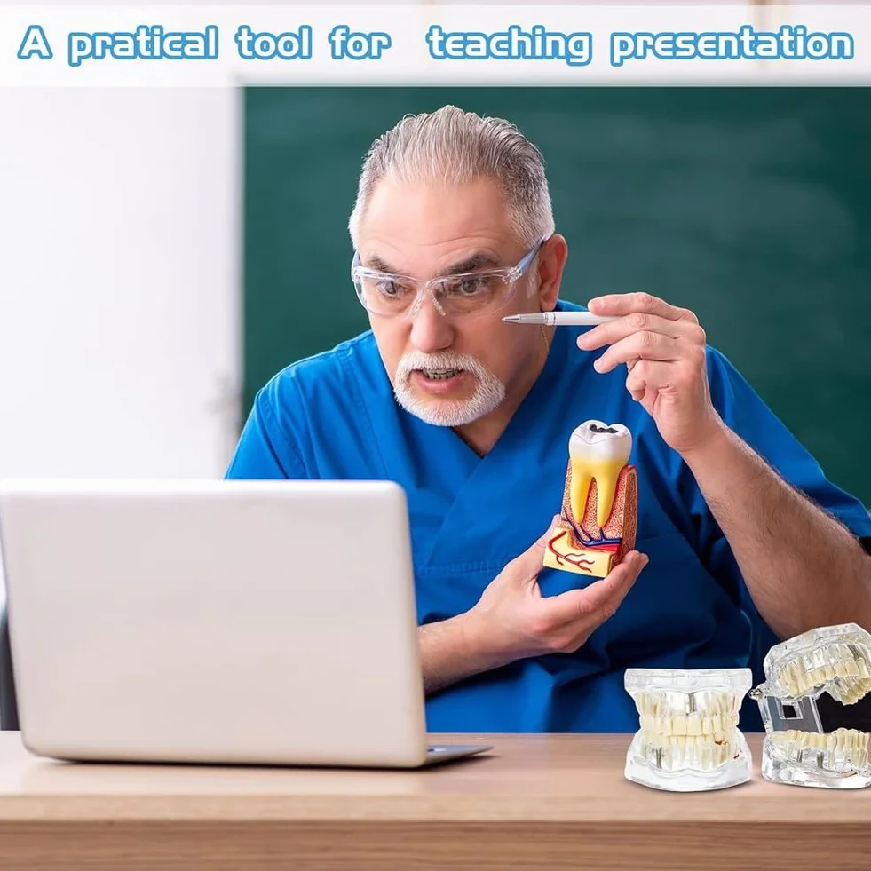 Typodonts Dental Modelo de Dientes para Implantes con Dientes Desmontables