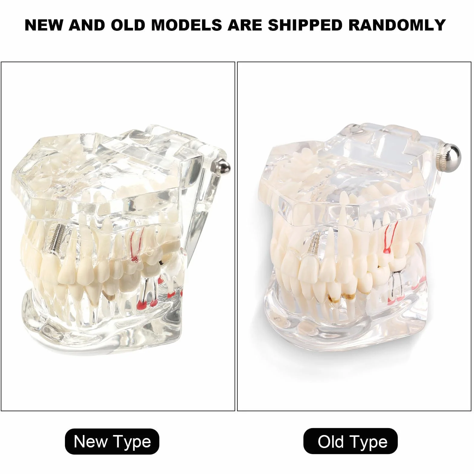 Modelo de Dientes Desmontable Adultos, Implantes Dentales, Enfermedad Transparente, Patología de Enseñanza