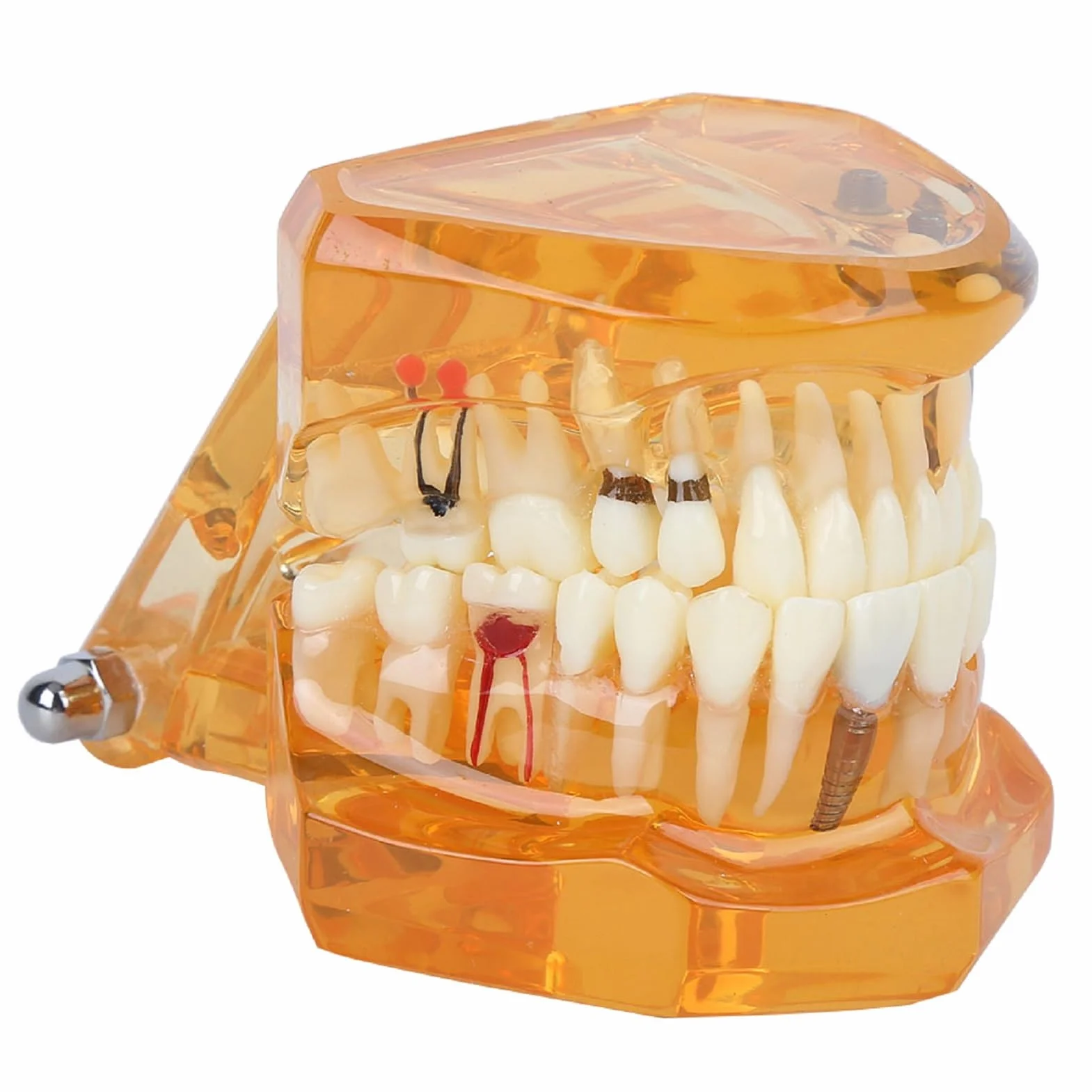 Modelo de Estudio de Dientes Dentales Extraíbles para Enseñanza Demostración Sobredentadura Maxilar Clínica Laboratorio Dentista