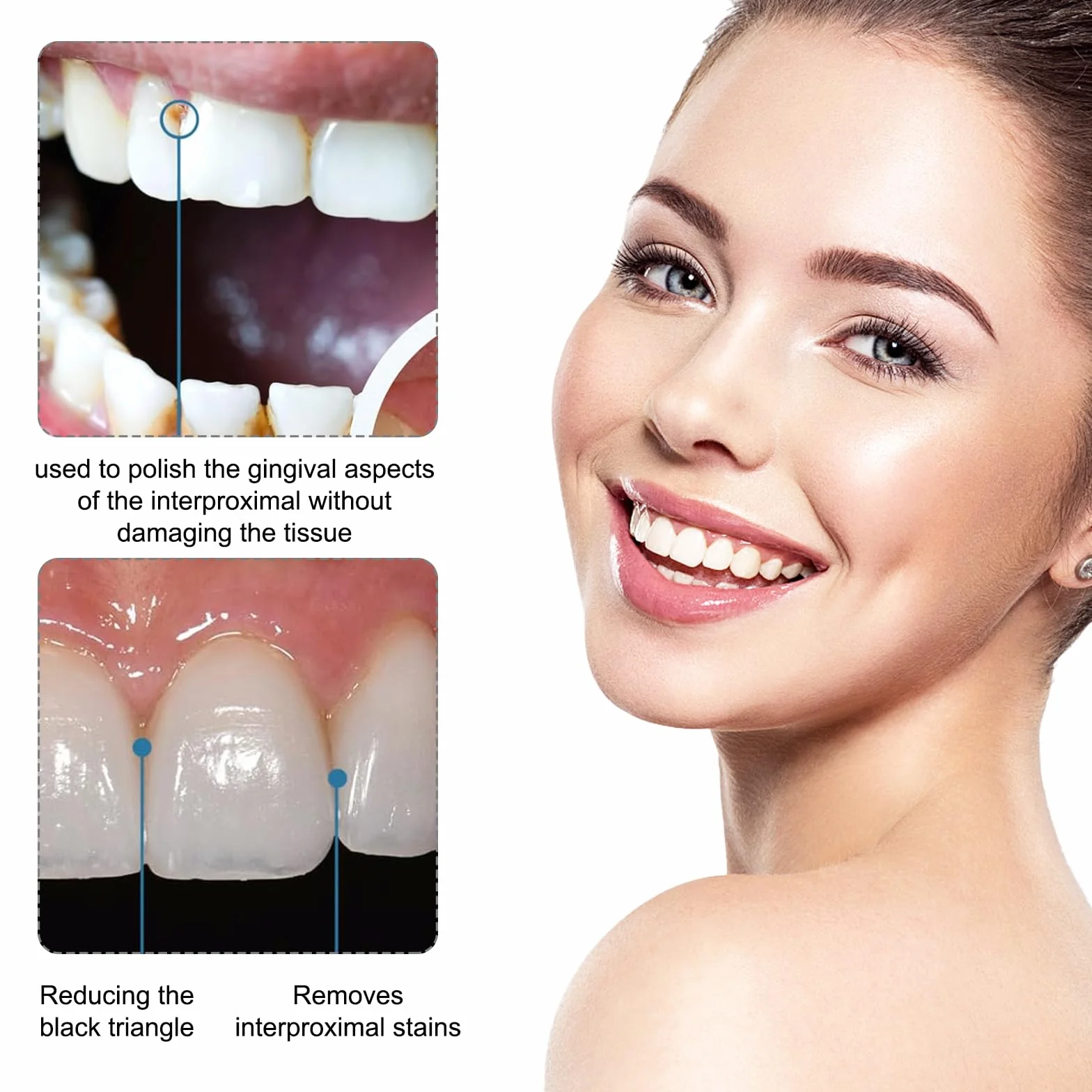 Papel De Lija Dental Tiras De Lijado Dental Tira De Pulido Dental Dientes Abrasivos 5 Pcs