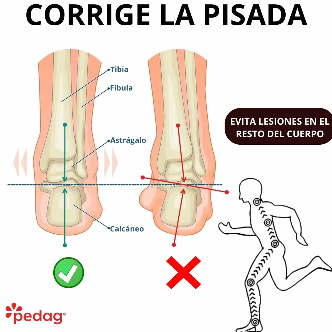 Plantillas Ortopedicas para Fascitis Plantar - Hechas a mano en Alemania