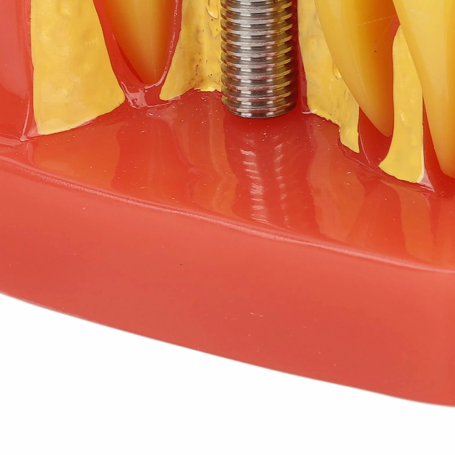 Modelo de implante Dental con Corona y Puente extraíbles para demostración y formación