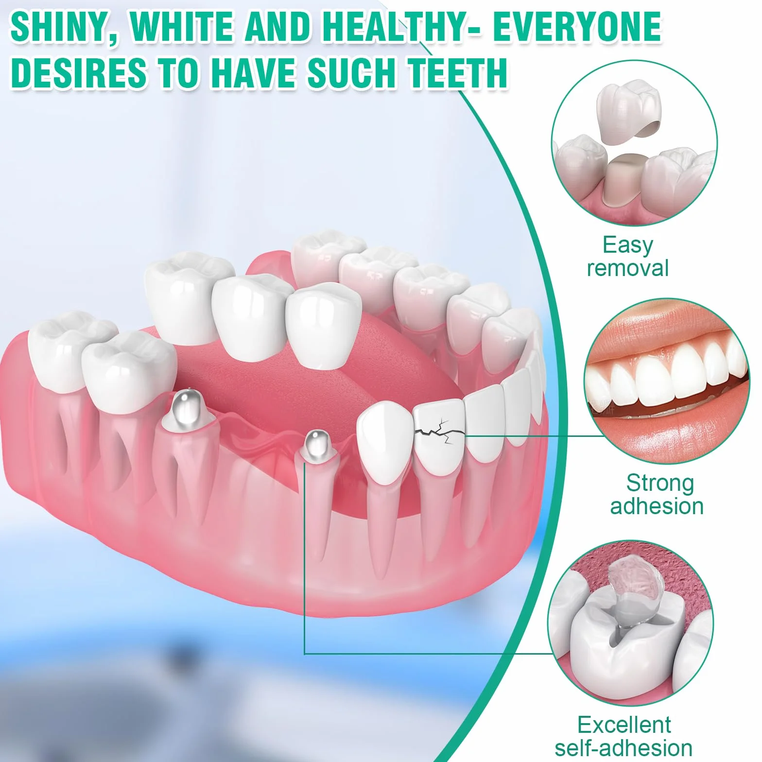 Cemento Dental Composite Kit de Fijación para Corona y Puente