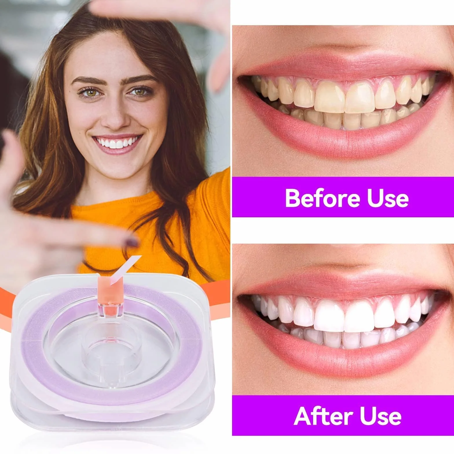 Tiras Dentales Pulidoras Doble Cara 50um Papel De Lija Dental Herramienta De Cuidado Oral
