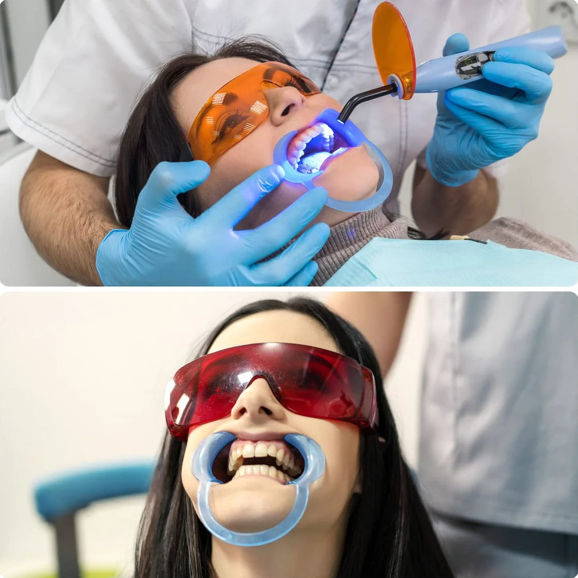 Vicloon Abridor de Boca Dental, 10pcs Retractores de Mejilla en Forma de C para Blanqueamiento de Dientes