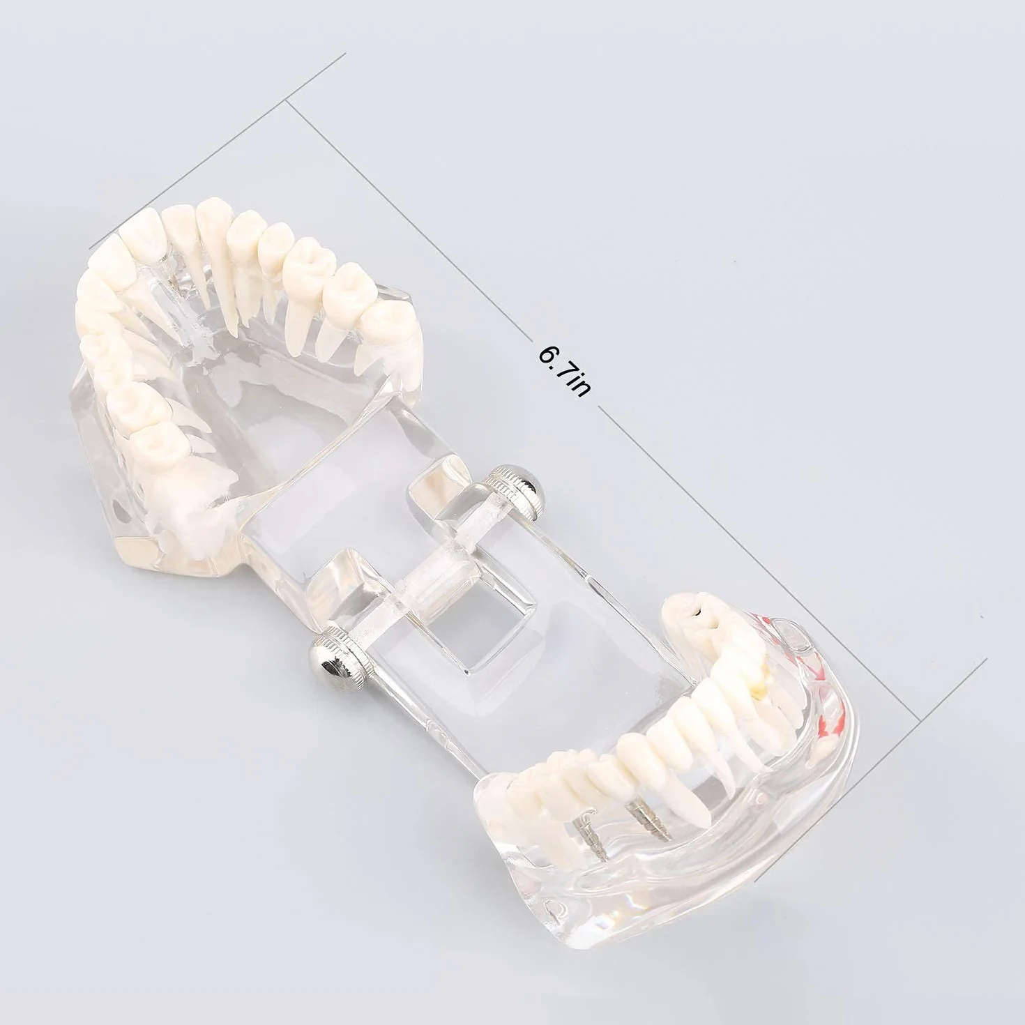 Modelo de Dientes Desmontable Adultos, Implantes Dentales, Enfermedad Transparente, Patología de Enseñanza