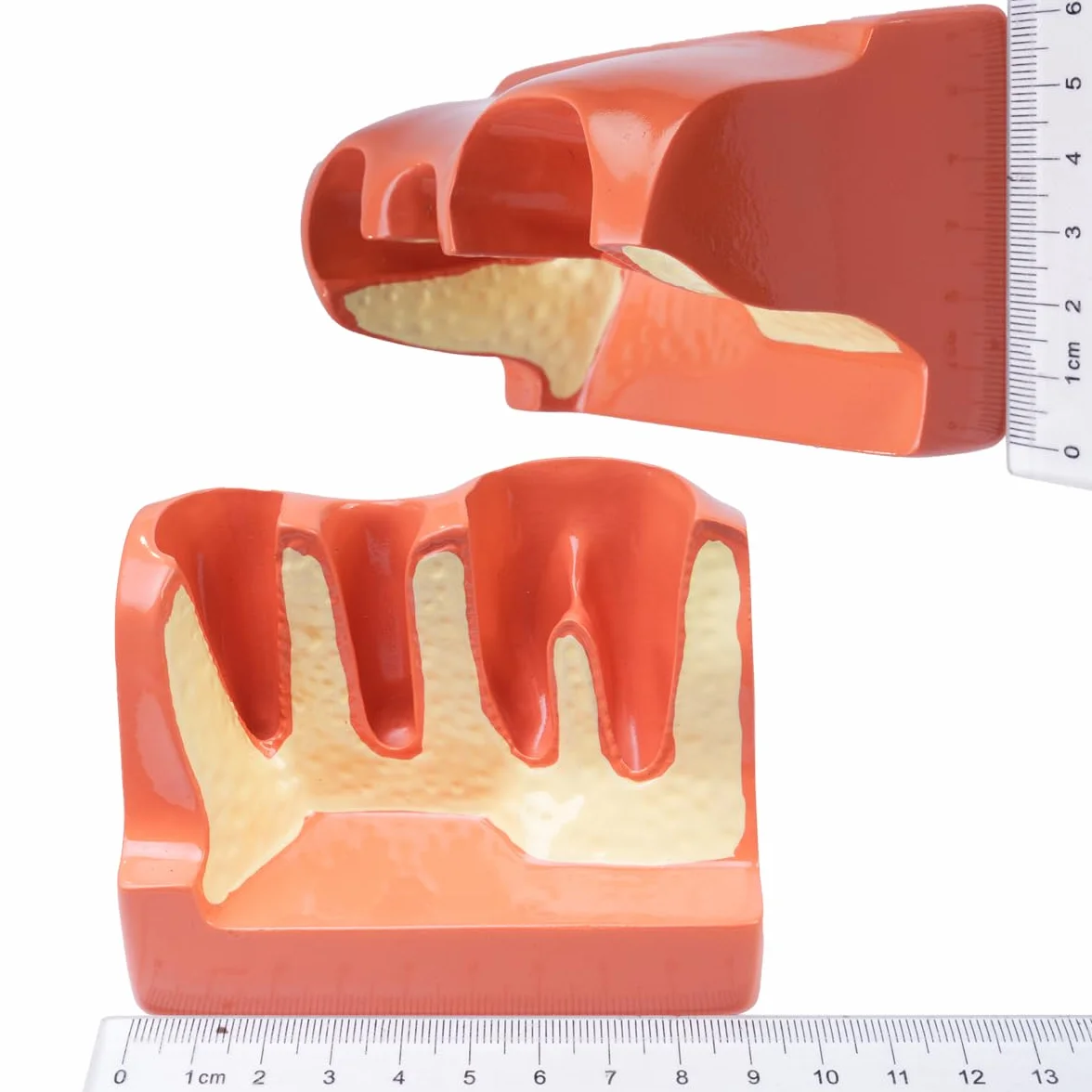 Sarini Modelo de Diente Oral, Modelo de implante Dental con Corona y Puente extraíbles para demostración y formación
