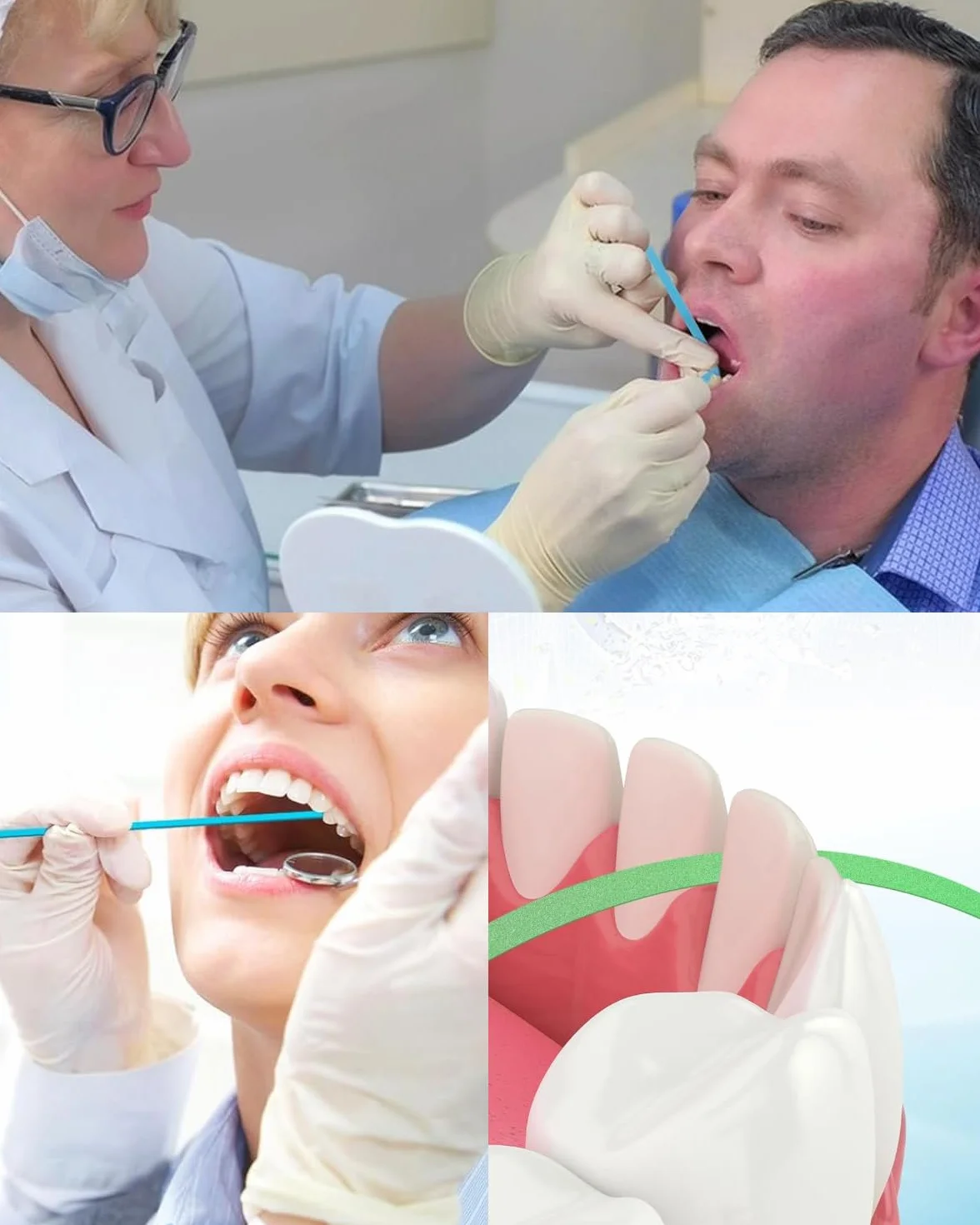 Papel de Lija Dental para Pulir Dientes Kit de Herramientas Resistente Limpieza Profunda Higiene Oral (60 Piezas)