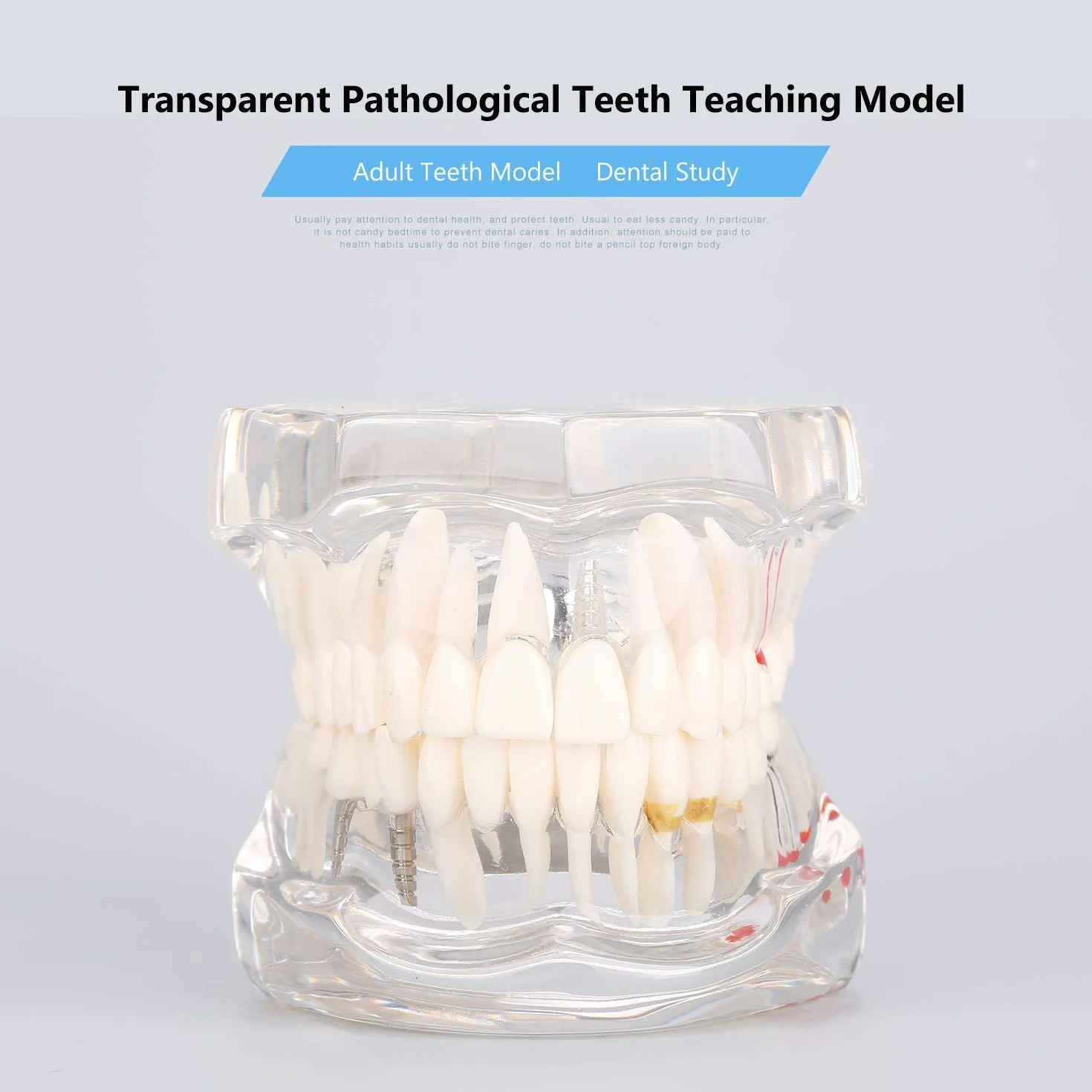 Modelo de Dientes Desmontable Adultos, Implantes Dentales, Enfermedad Transparente, Patología de Enseñanza