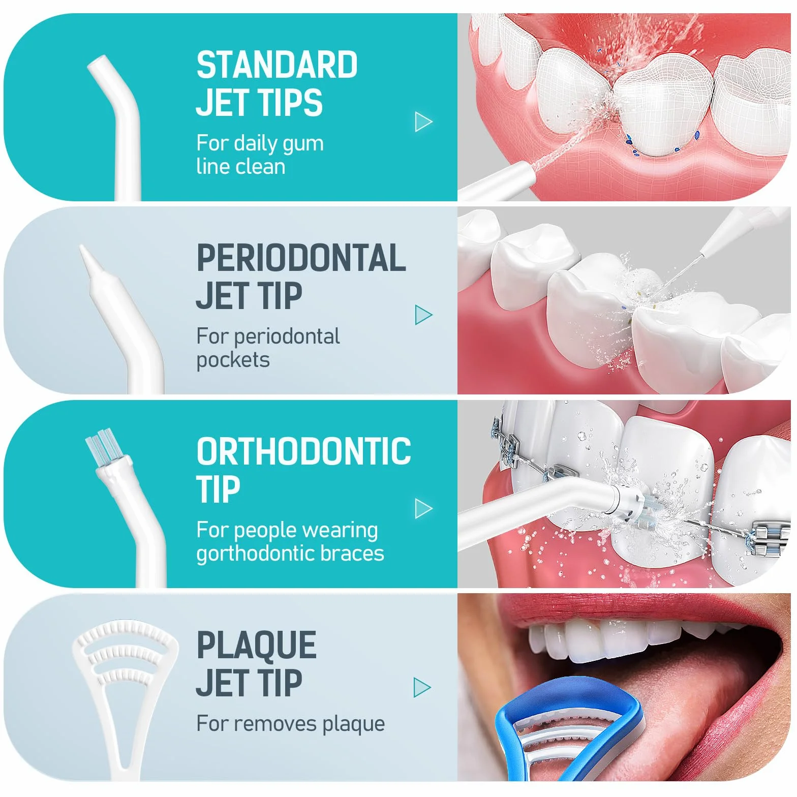 Morpilot Irrigador Bucal Dental Inalámbrico 3 Modos 5 Boquillas IPX7 300ML